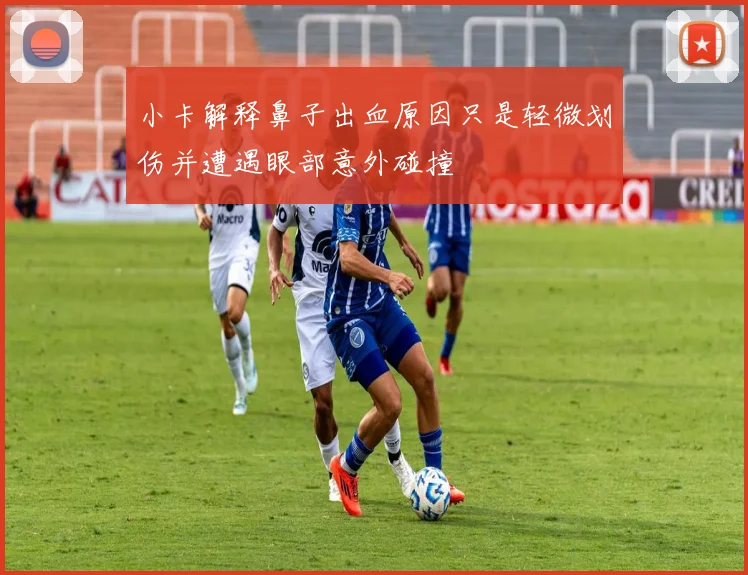 小卡解释鼻子出血原因只是轻微划伤并遭遇眼部意外碰撞